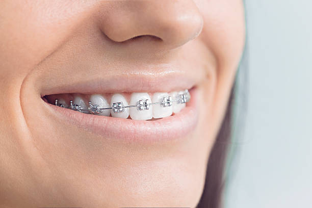 Best Veneers and Lumineers  in Deerfield Beach, FL